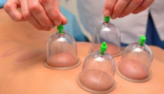 depositphotos_43718495-stock-photo-cupping-therapy-woman-doctor-removes